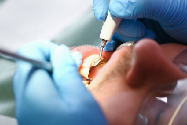 Best Weekend Emergency Dentist in Cherryville, NC