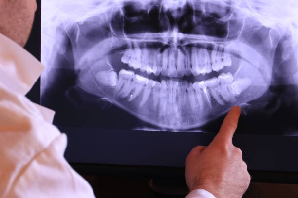  Cherryville, NC Emergency Dentist Pros